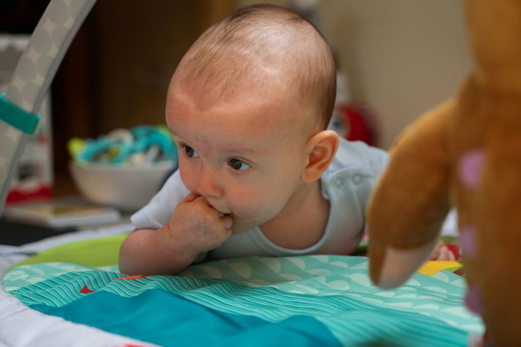 Lawyer challenges scientific basis of shaken baby diagnoses